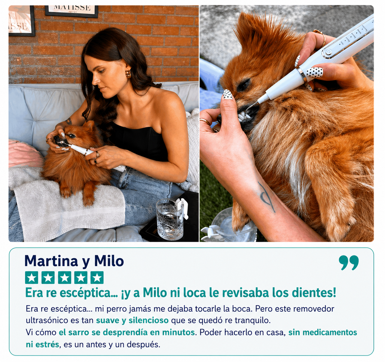 Kit Sonrisa Canina | Removedor Ultrasónico de Sarro